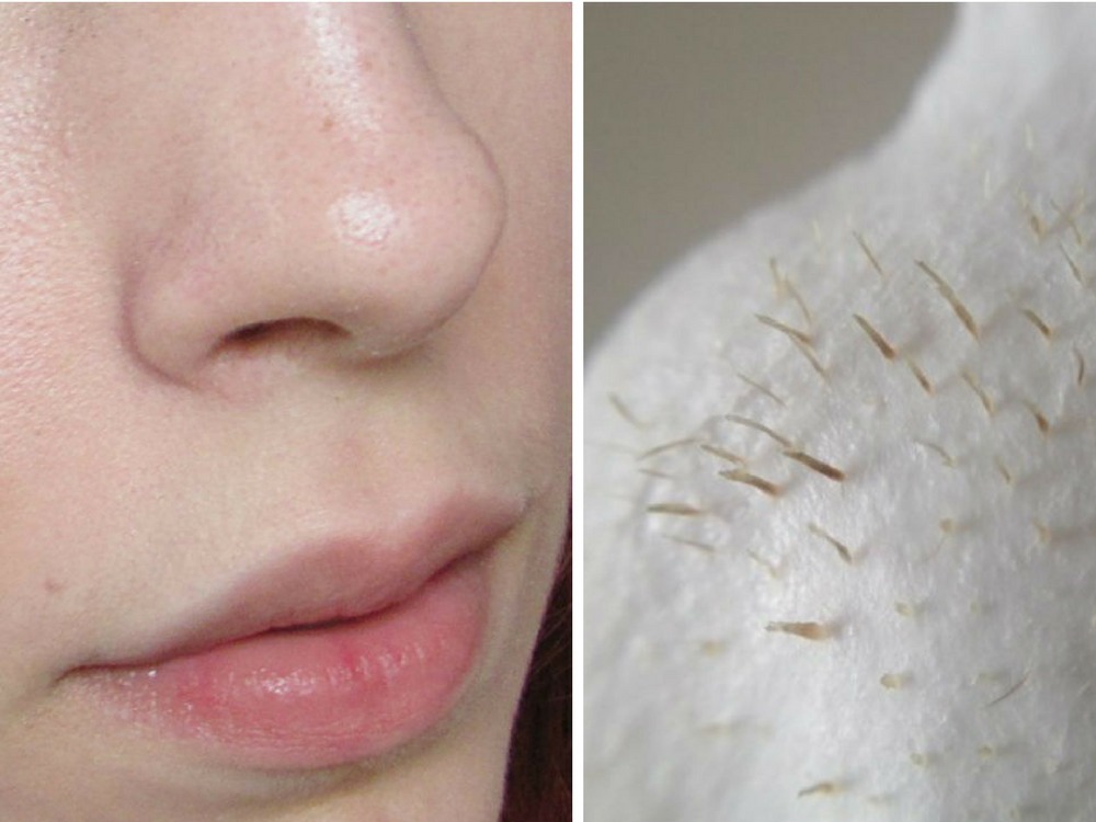 8 cach loai bo soi ba nhon de da sach thoang